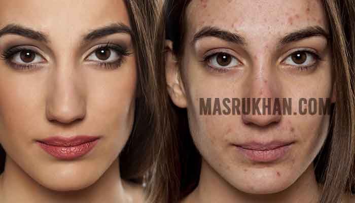 akibat-melanggar-pantangan-susuk